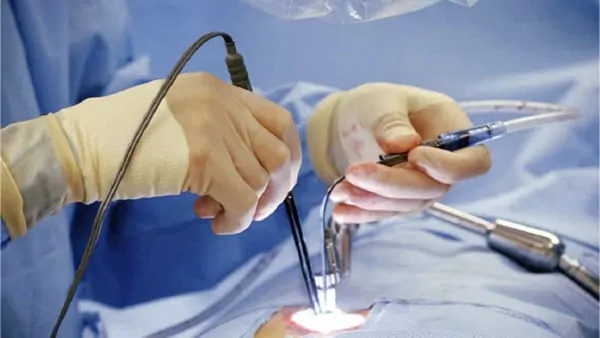 chirurgie mini invasive du canal lombaire etroit la chirurgie mini invasive hernie discale espace francilien du rachis clinique du rachis versailles paris 9