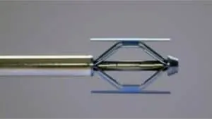 Ballonnet de cyphoplastie monté sur son instrument, utilisé pour relever la vertèbre tassée