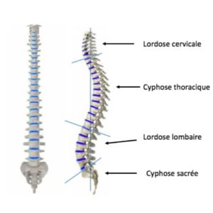 Scoliose Lombaire La Scoliose Adulte Operation Scoliose Adulte ...