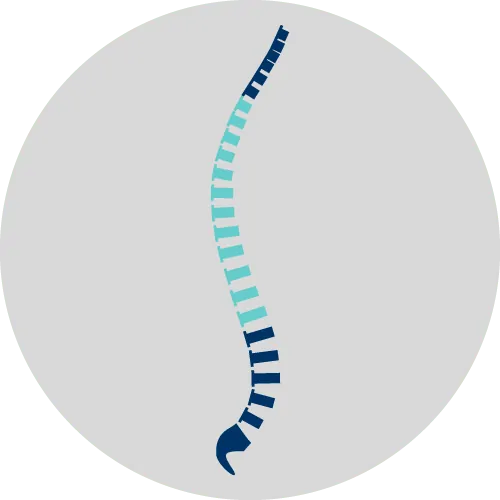 scoliose lombaire scoliose adulte scoliose definition scoliose traitement scoliose symptome scoliose douleur scoliose grave espace francilien du rachis
