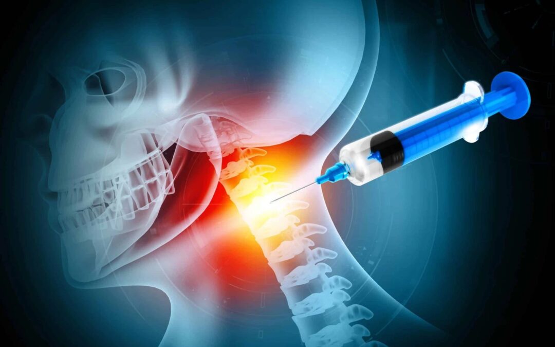 Infiltration cervicale : est-elle interdite, combien de temps agit-elle et que faire après ?